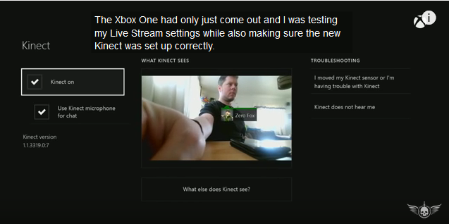 Unexplained Xbox One Kinect